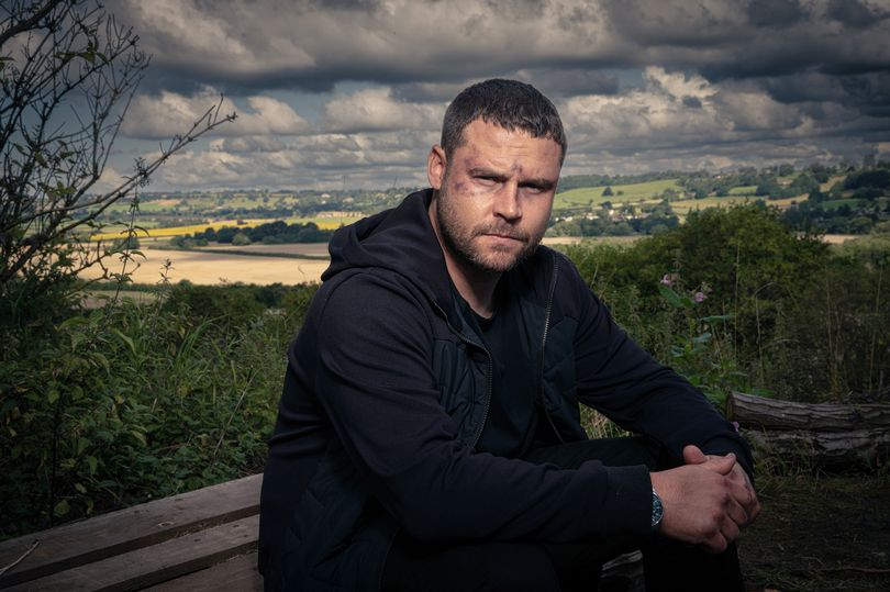 Read more about the article Emmerdale legend Danny Miller deletes social media account after horrid fat shaming abuse